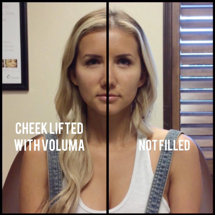 My Clarity Skin Story